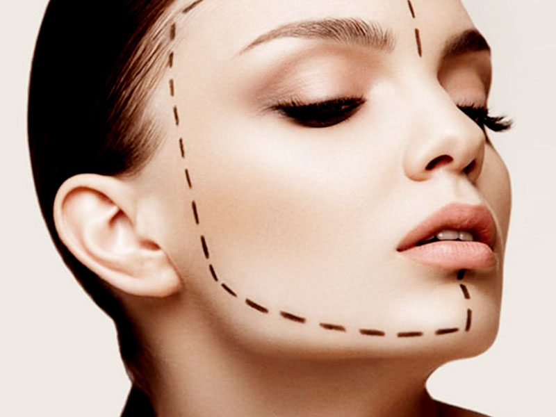 زاویه‌سازی صورت با فیلر و بوتاکس