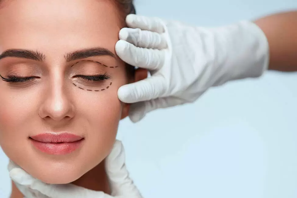 مزایا و معایب عمل بلفاروپلاستی