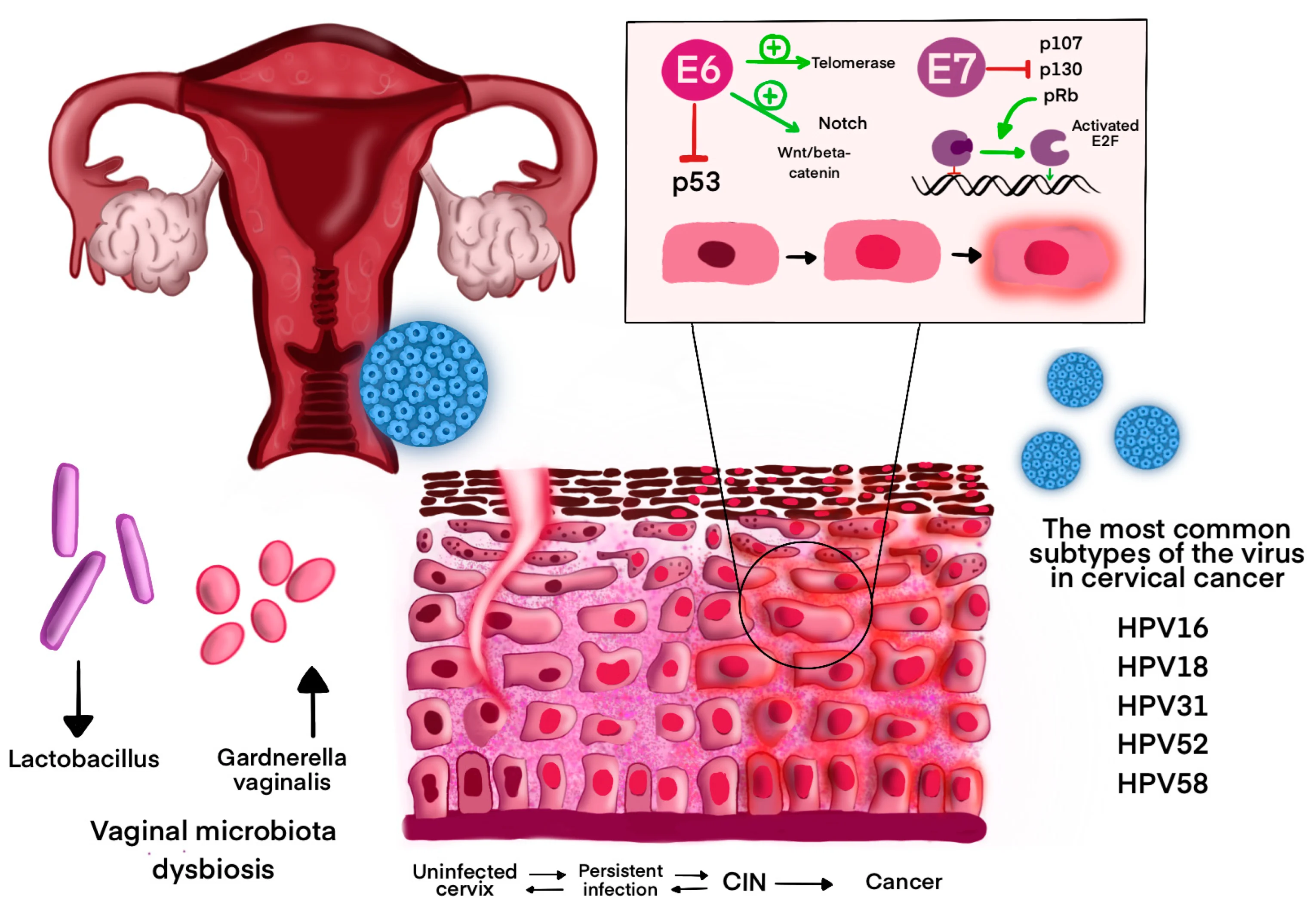 زگیل تناسلی، HIV و واقعیت علمی — تفاوت، تشخیص و پیشگیری