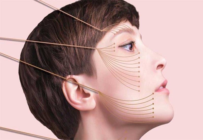 لیفت با نخ چیه ؟